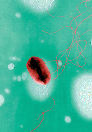 Image: Transmission electron micrograph of Escherichia coli (Photo courtesy of Elizabeth H. White).